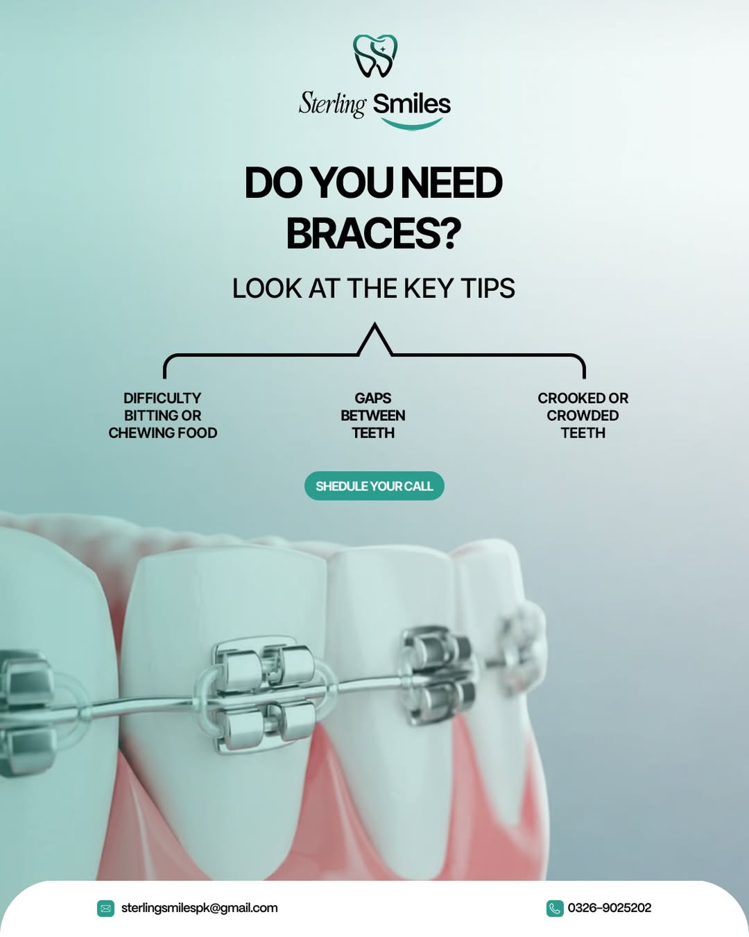 Sterling Smiles guidance about braces